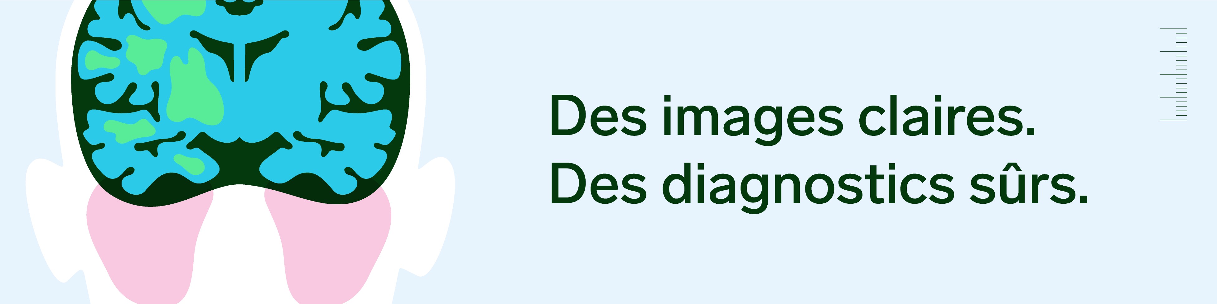 imagix imagerie medicale linkedin